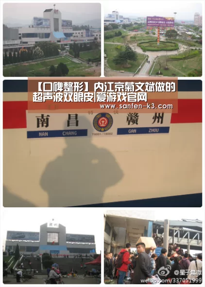 【口碑整形】内江京菊文斌做的超声波双眼皮|爱游戏官网(图2) 爱游戏APP下载